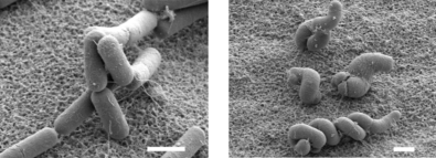 science_SEM_G2vBGy_crop_WT_Dmbl_scale